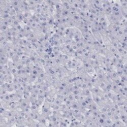 Invitrogen MC2R Polyclonal Antibody 100 μL; Unconjugated:Antibodies,