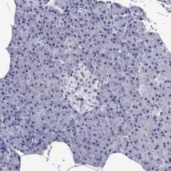 Invitrogen MC2R Polyclonal Antibody 100 μL; Unconjugated:Antibodies,