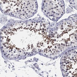 Invitrogen MLF1 Polyclonal Antibody 100 &mu;L; Unconjugated:Antibodies,