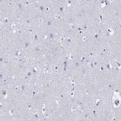 Invitrogen DDI1 Polyclonal Antibody 100 &mu;L | Buy Online | Invitrogen&trade; | Fisher Scientific