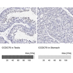 Invitrogen CCDC70 Polyclonal Antibody 100 &mu;L; Unconjugated:Antibodies,