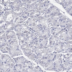 Invitrogen CCDC70 Polyclonal Antibody 100 &mu;L; Unconjugated:Antibodies,