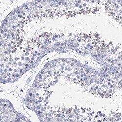 Invitrogen CCDC70 Polyclonal Antibody 100 &mu;L; Unconjugated:Antibodies,