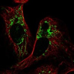 Invitrogen HRASLS3 Polyclonal Antibody 100 &mu;L; Unconjugated:Antibodies,