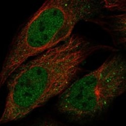 Invitrogen B4GALNT4 Polyclonal Antibody 100 &mu;L; Unconjugated:Antibodies,