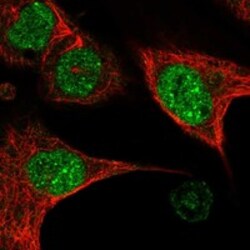 Invitrogen BDP1 Polyclonal Antibody 100 &mu;L; Unconjugated:Antibodies,