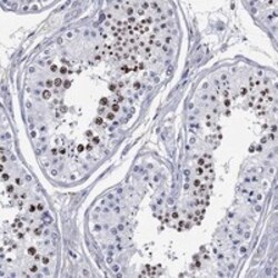 Invitrogen CDY2B Polyclonal Antibody 100 &mu;L; Unconjugated:Antibodies,