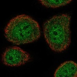 Invitrogen ATAD5 Polyclonal Antibody 100 &mu;L | Buy Online | Invitrogen&trade; | Fisher Scientific