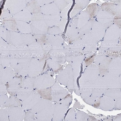 Invitrogen Septin 1 Polyclonal Antibody 100 &mu;L; Unconjugated:Antibodies,