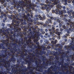 Invitrogen Septin 1 Polyclonal Antibody 100 &mu;L; Unconjugated:Antibodies,