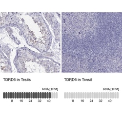 Invitrogen TDRD6 Polyclonal Antibody 100 &mu;L; Unconjugated:Antibodies,