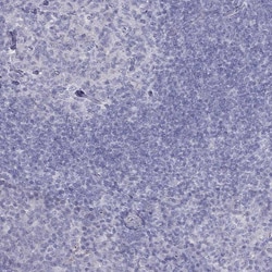 Invitrogen TDRD6 Polyclonal Antibody 100 &mu;L; Unconjugated:Antibodies,
