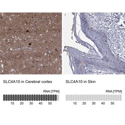 Invitrogen SLC4A10 Polyclonal Antibody 100 &mu;L; Unconjugated:Antibodies,