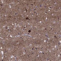 Invitrogen SLC4A10 Polyclonal Antibody 100 &mu;L; Unconjugated:Antibodies,