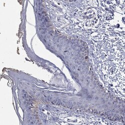 Invitrogen SLC4A10 Polyclonal Antibody 100 &mu;L; Unconjugated:Antibodies,