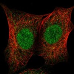 Invitrogen ZNF206 Polyclonal Antibody 100 &mu;L; Unconjugated:Antibodies,