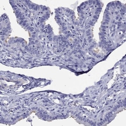 Invitrogen KIAA2012 Polyclonal Antibody 100 &mu;L; Unconjugated:Antibodies,