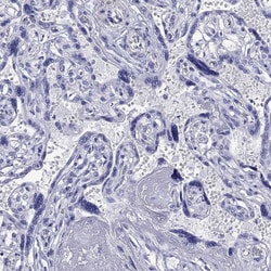 Invitrogen KIAA2012 Polyclonal Antibody 100 &mu;L; Unconjugated:Antibodies,