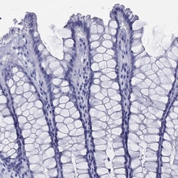Invitrogen TMEM252 Polyclonal Antibody 100 &mu;L; Unconjugated:Antibodies,