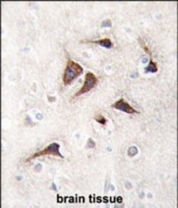 Invitrogen CaMKII delta Polyclonal Antibody 400 &mu;L; Unconjugated:Antikroppar