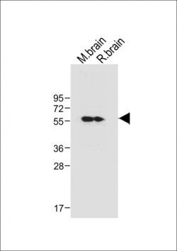 Invitrogen CaMKII delta Polyclonal Antibody 400 &mu;L; Unconjugated:Antikroppar