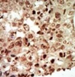Invitrogen p38 MAPK beta Polyclonal Antibody 400 &mu;L; Unconjugated:Antibodies,