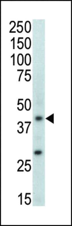 Invitrogen p38 MAPK beta Polyclonal Antibody 400 &mu;L; Unconjugated:Antibodies,