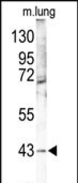 p38 MAPK gamma Polyclonal Antibody:Antibodies, Polyclonal