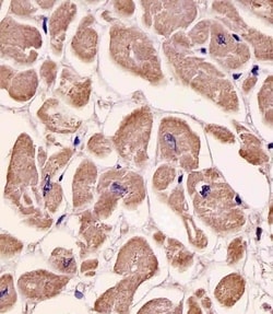 SPHK1 Polyclonal Antibody:Antibodies, Polyclonal