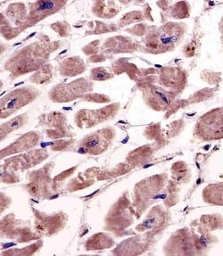 SPHK1 Polyclonal Antibody:Antibodies, Polyclonal