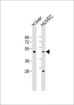 SPHK1 Polyclonal Antibody:Antibodies, Polyclonal