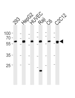 SPHK1 Polyclonal Antibody:Antibodies, Polyclonal
