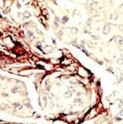 LKB1 Polyclonal Antibody:Antibodies, Polyclonal