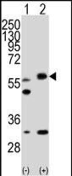 LKB1 Polyclonal Antibody:Antibodies, Polyclonal