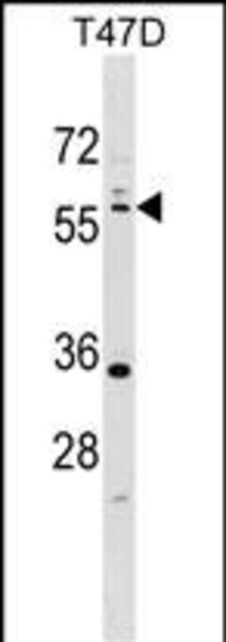 LKB1 Polyclonal Antibody:Antibodies, Polyclonal