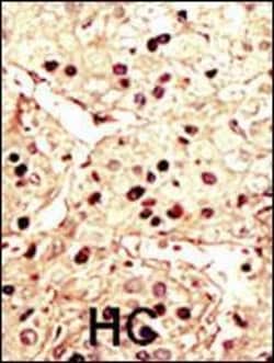 Invitrogen Aurora B Polyclonal Antibody 400 &mu;L; Unconjugated:Antibodies,
