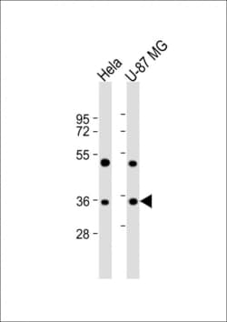 Invitrogen Aurora B Polyclonal Antibody 400 &mu;L; Unconjugated:Antibodies,