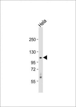 Invitrogen CDKL5 Polyclonal Antibody 400 &mu;L | Buy Online | Invitrogen&trade; | Fisher Scientific