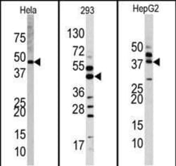 Invitrogen ERK2 Polyclonal Antibody 400 &mu;L; Unconjugated:Antibodies,