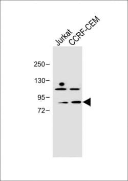 Invitrogen PLK2 Polyclonal Antibody 400 &mu;L; Unconjugated:Antibodies,