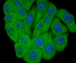 Invitrogen ALDH1A1 Polyclonal Antibody 100 &mu;L; Unconjugated:Antibodies,
