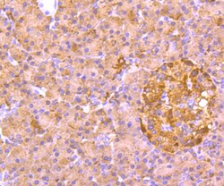 Invitrogen ALDH1A1 Polyclonal Antibody 100 &mu;L; Unconjugated:Antibodies,