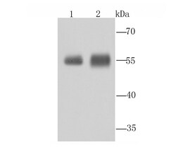Invitrogen ALDH1A1 Polyclonal Antibody 100 &mu;L; Unconjugated:Antibodies,