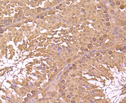 Invitrogen NSUN4 Polyclonal Antibody 100 &mu;L; Unconjugated:Antibodies,