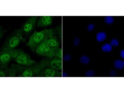 Invitrogen HDAC2 Polyclonal Antibody 100 μL; Unconjugated:Antibodies,