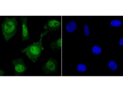 Invitrogen HDAC2 Polyclonal Antibody 100 μL; Unconjugated:Antibodies,