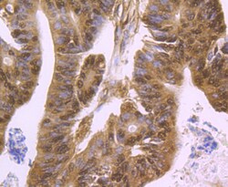 Invitrogen HDAC2 Polyclonal Antibody 100 μL; Unconjugated:Antibodies,