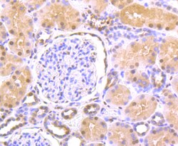 Invitrogen HDAC2 Polyclonal Antibody 100 μL; Unconjugated:Antibodies,