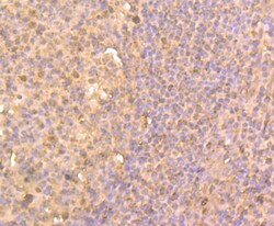 Invitrogen HDAC2 Polyclonal Antibody 100 μL; Unconjugated:Antibodies,