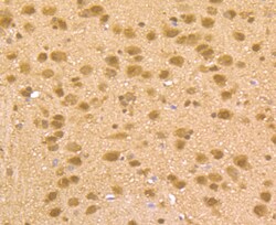 Invitrogen HDAC2 Polyclonal Antibody 100 μL; Unconjugated:Antibodies,